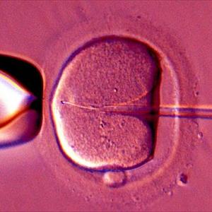 Fertility Planner Calendar - Prashanth Infertility Treatment And Ivf Treatment