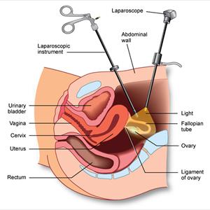Chinese Conception Calendar Accurate - Herbal Remedies To Treat Male Infertility Successfully